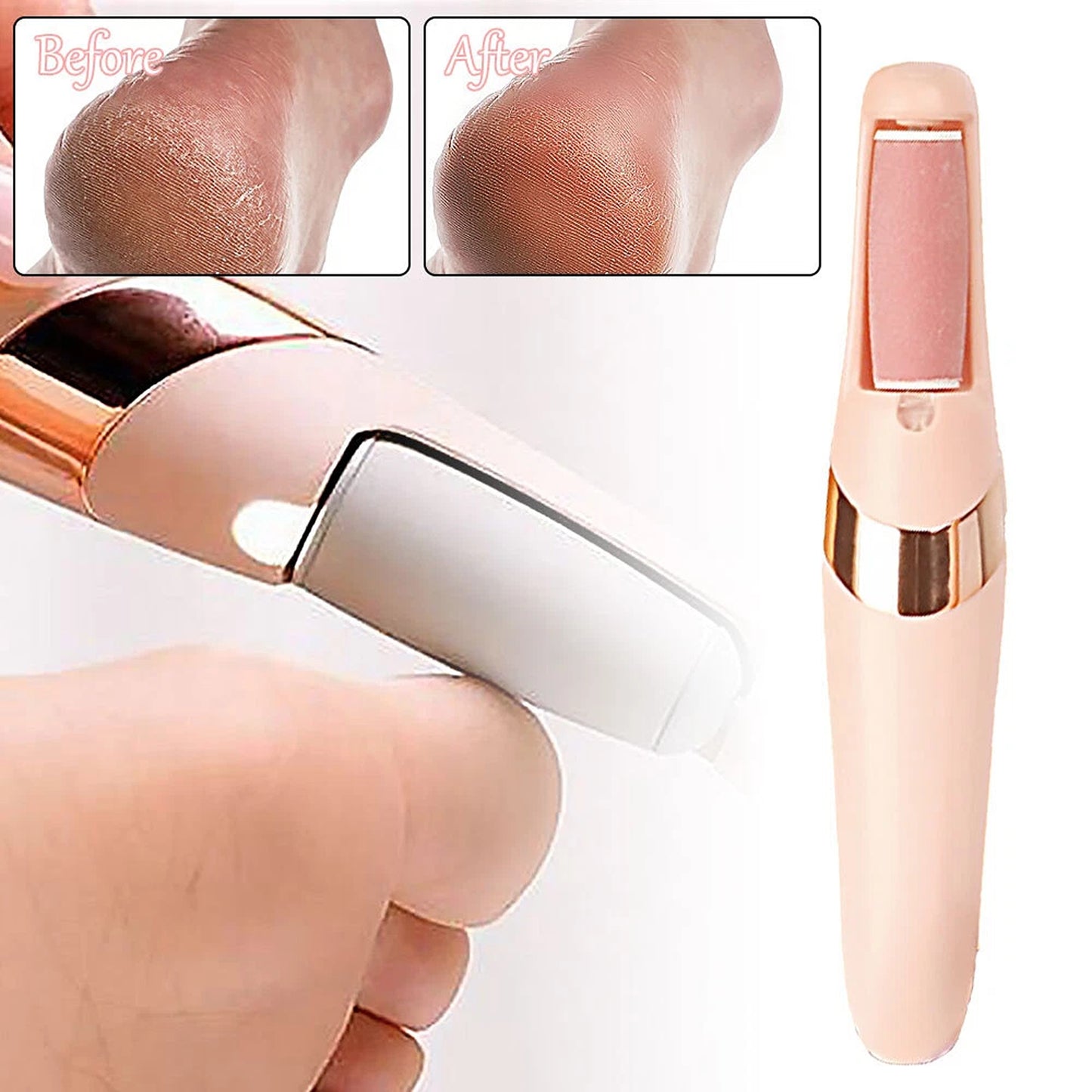 Electric Foot Callus Remover USB Rechargeable Pedicure Tool