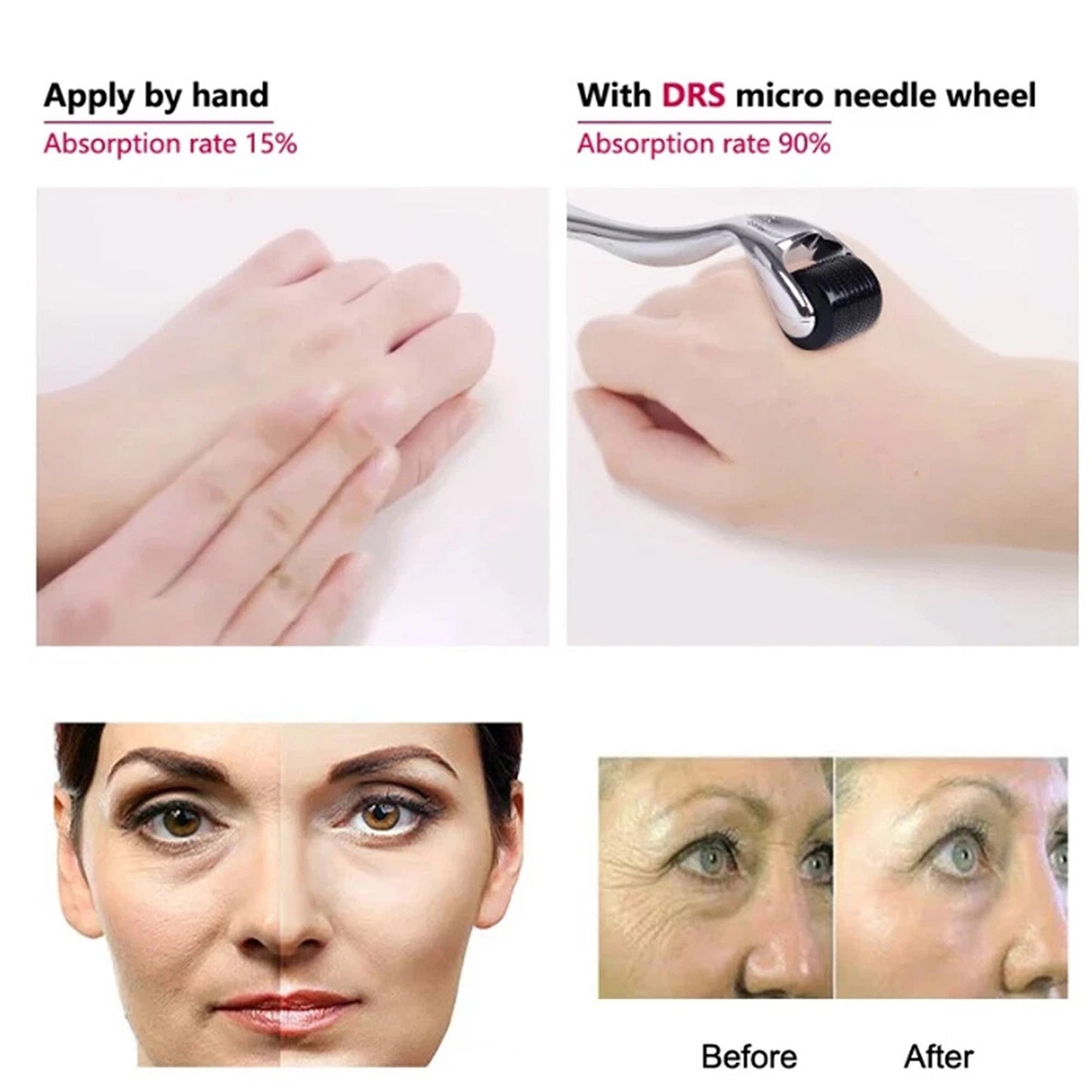 540 Titanium Derma Roller for Beard Hair and Skin Care
