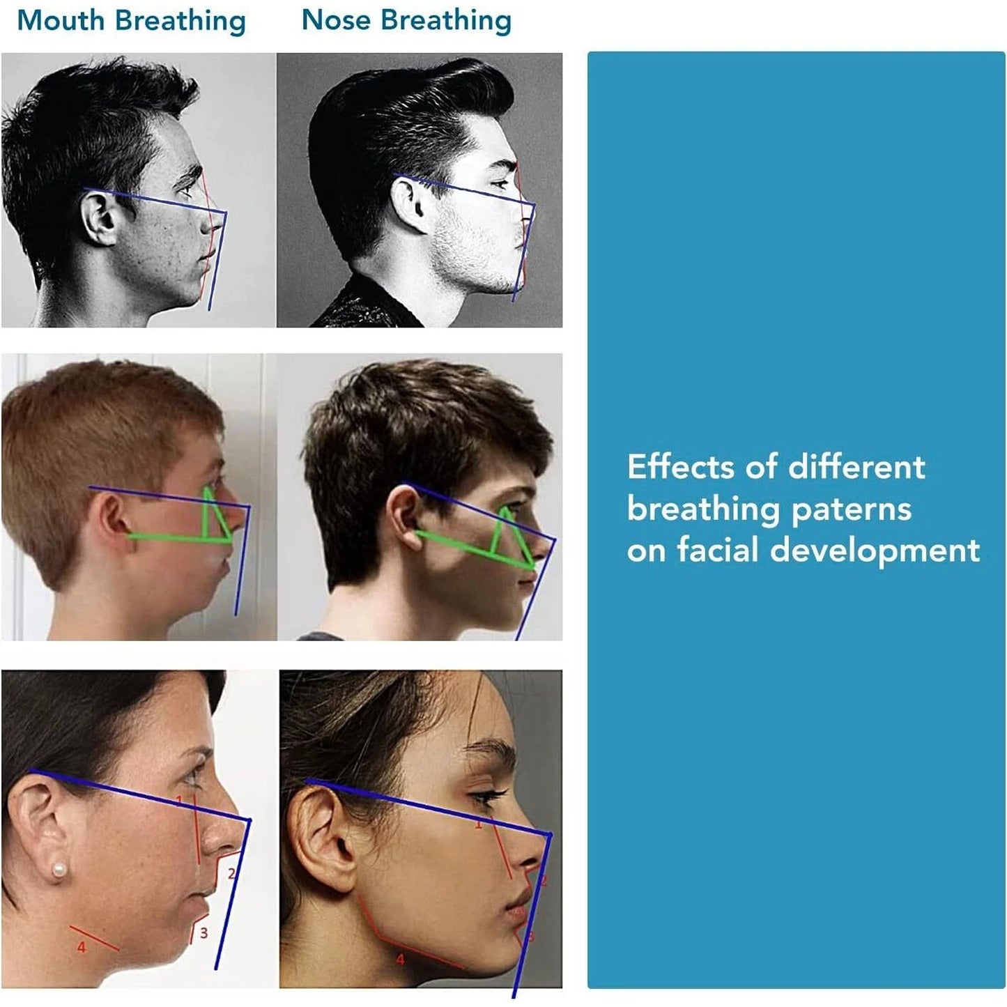 Mouth Tape Strips for Snoring Relief and Nose Breathing 90pcs