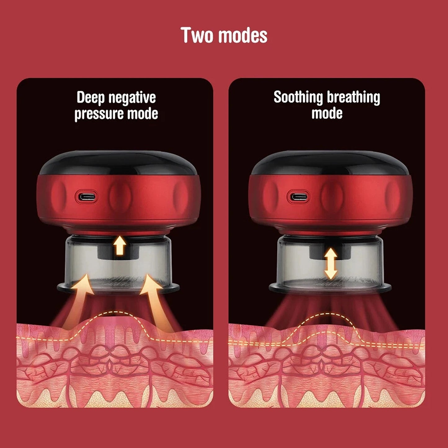 Electric Cupping Therapy Machine with Heat and Suction