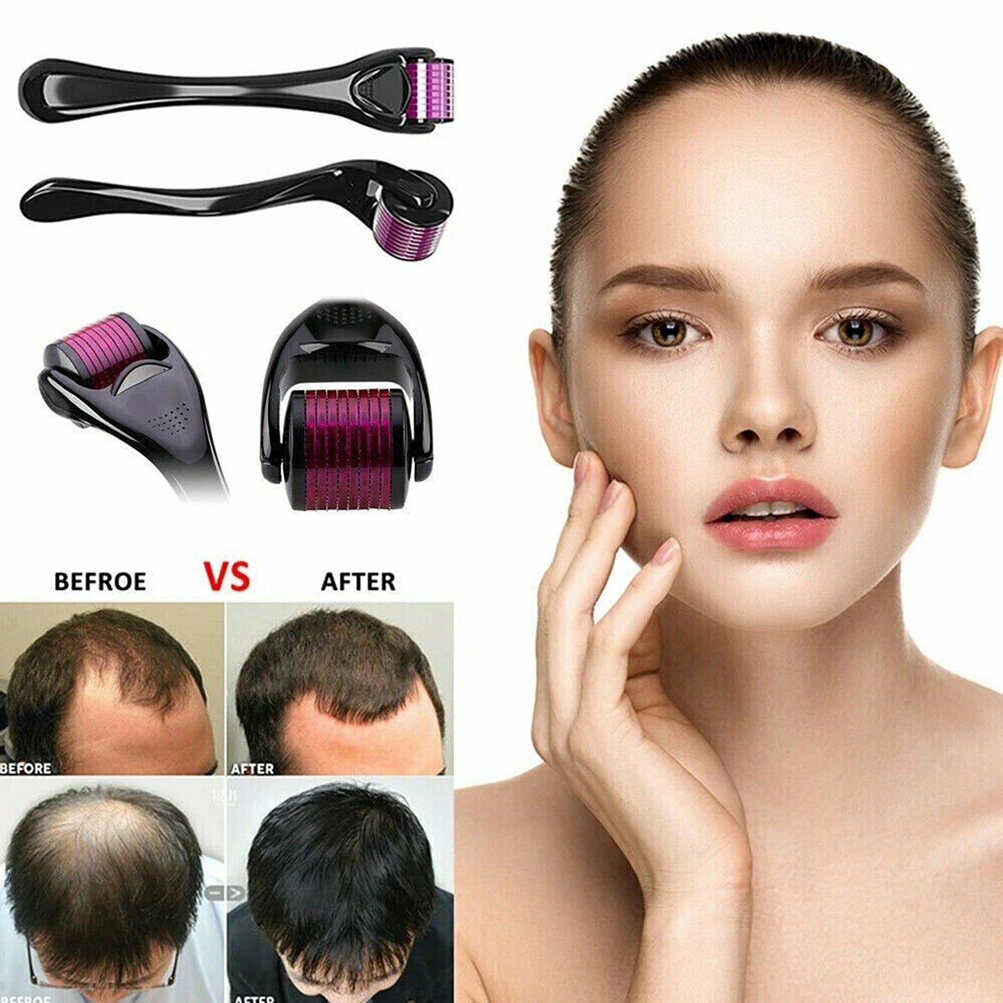 540 Titanium Derma Roller for Beard Hair and Skin Care