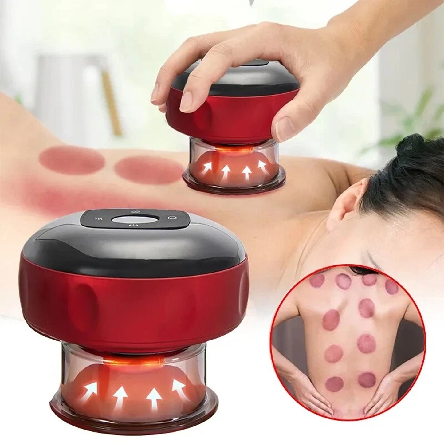Electric Cupping Therapy Machine with Heat and Suction